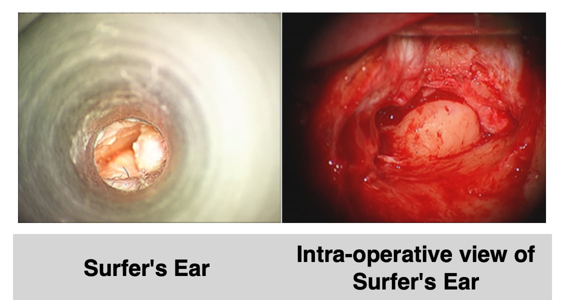 Outer ear problems